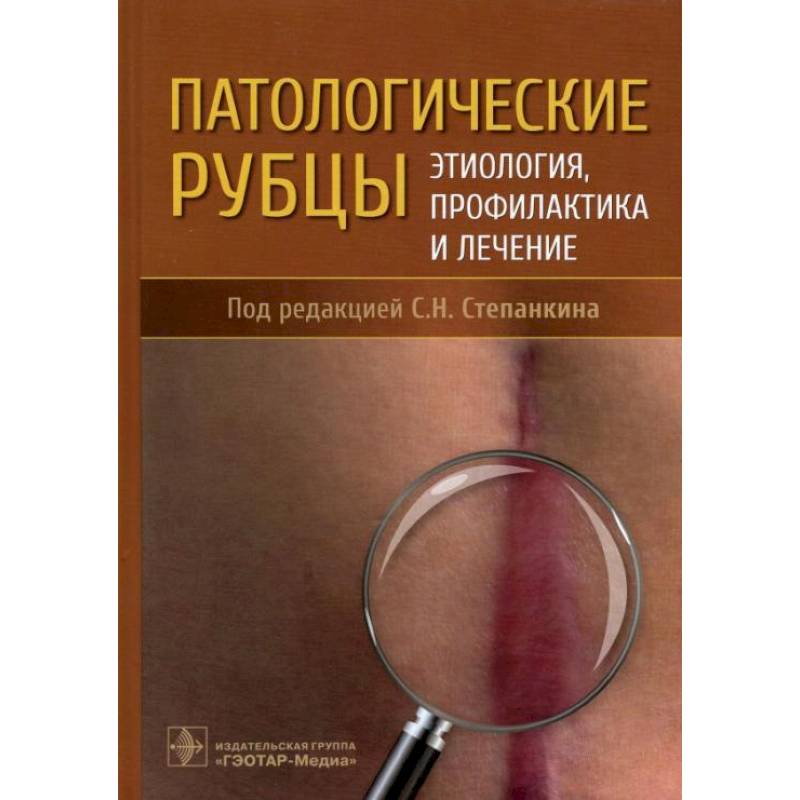 Фото Патологические рубцы. Этиология, профилактика и лечение