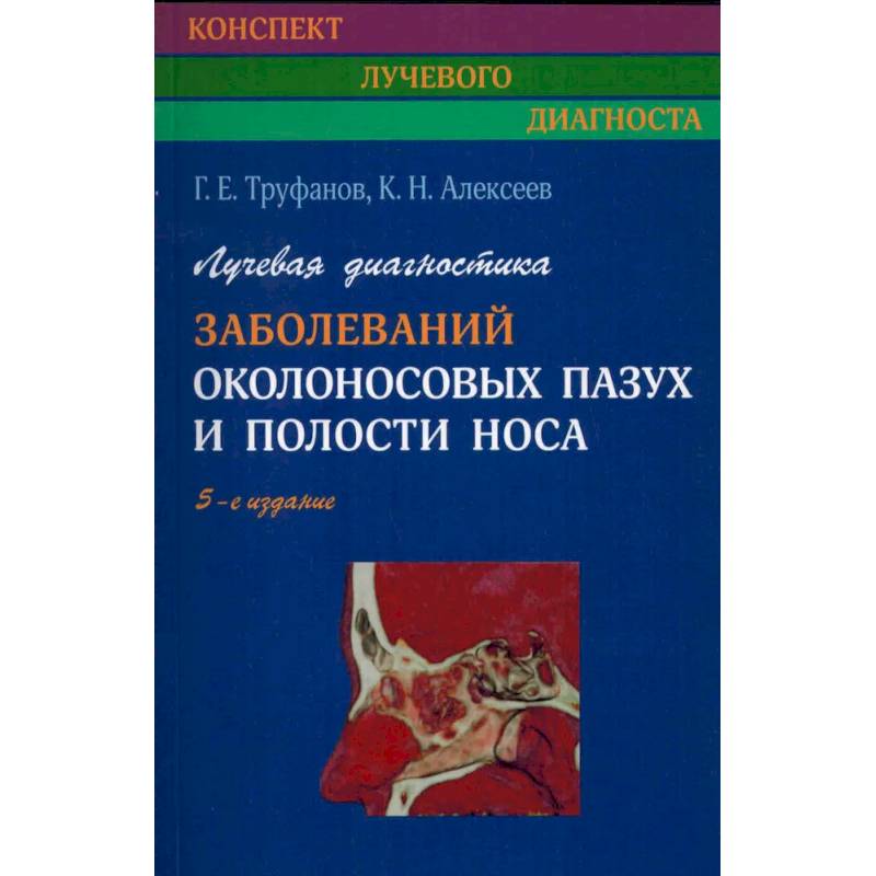Фото Лучевая диагностика заболеваний околоносовых пазух и полости носа.