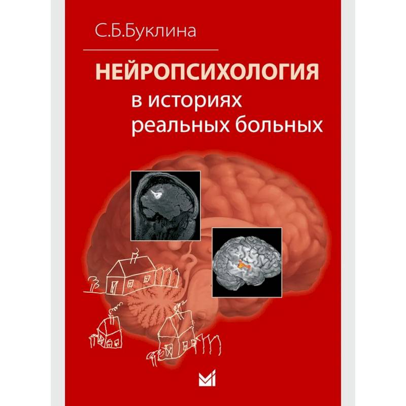 Фото Нейропсихология в историях реальных больных