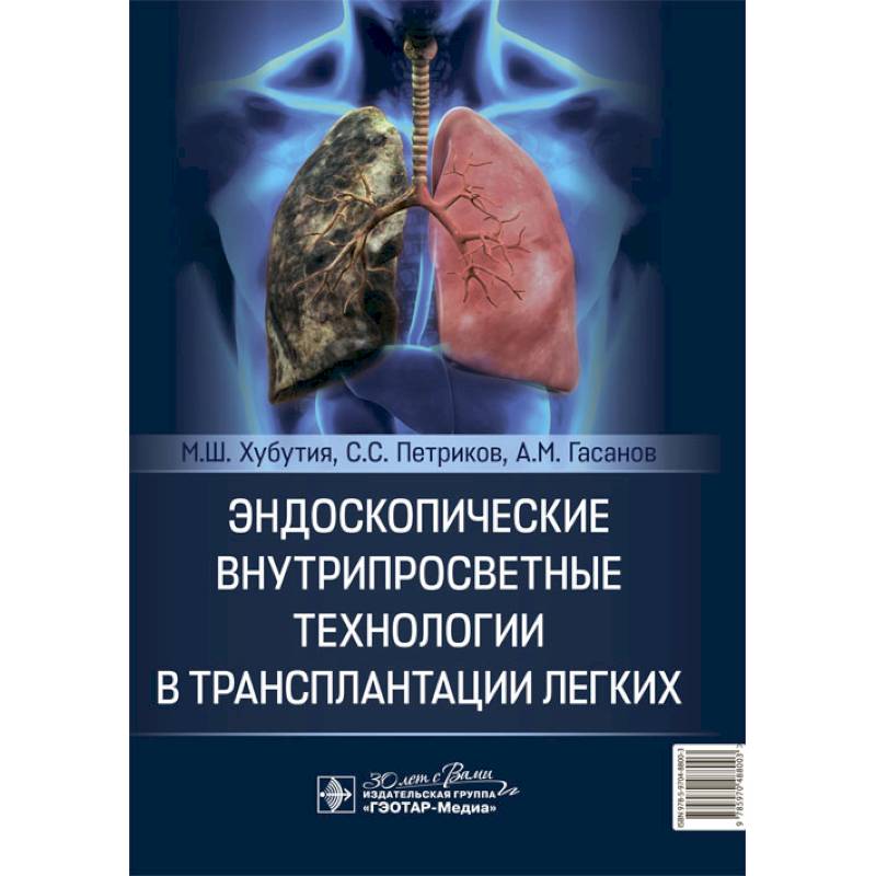 Фото Эндоскопические внутрипросветные технологии в трансплантации легких