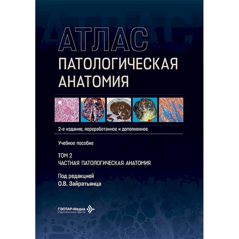 Фото Патологическая анатомия. Атлас.. Том  2: Частная патологическая анатомия: Учебное пособие.