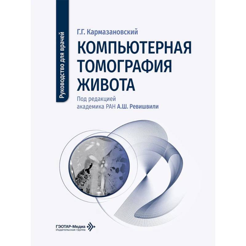 Фото Компьютерная томография живота: руководство для врачей