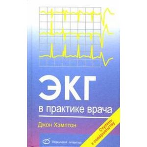 Фото ЭКГ в практике врача