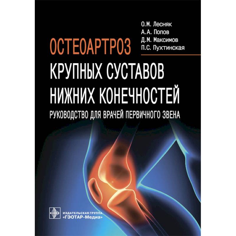Фото Остеоартроз крупных суставов нижних конечностей