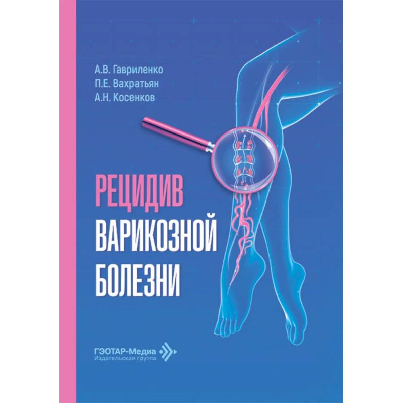 Фото Рецидив варикозной болезни
