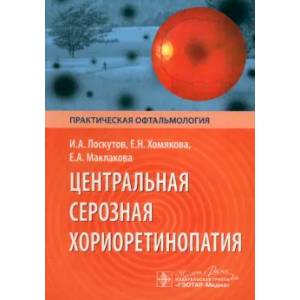 Фото Центральная серозная хориоретинопатия