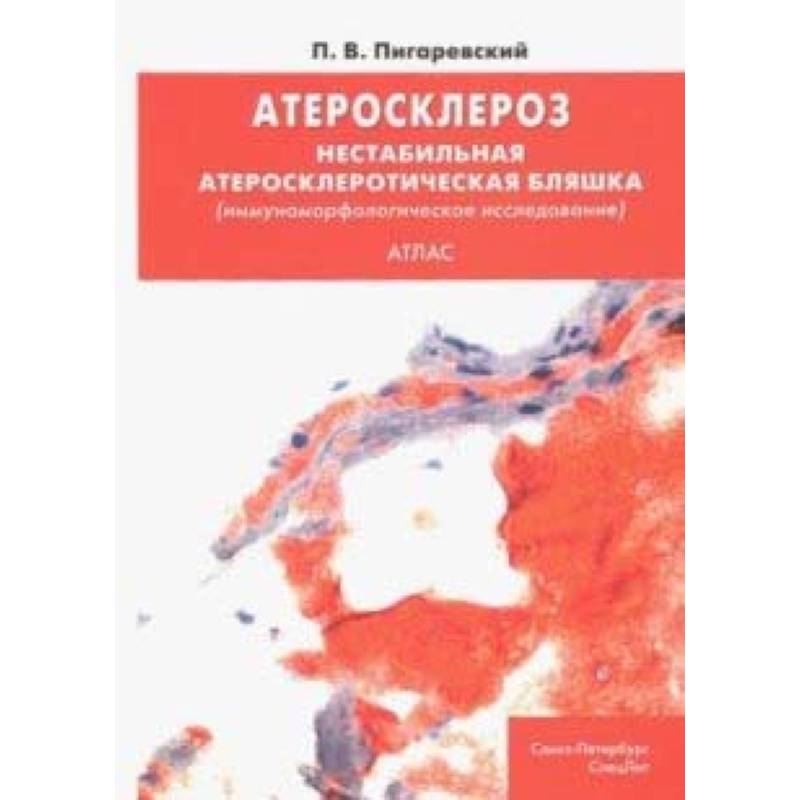 Фото Атеросклероз. Нестабильная атеросклеротическая бляшка (иммуноморфологическое исследование). Атлас