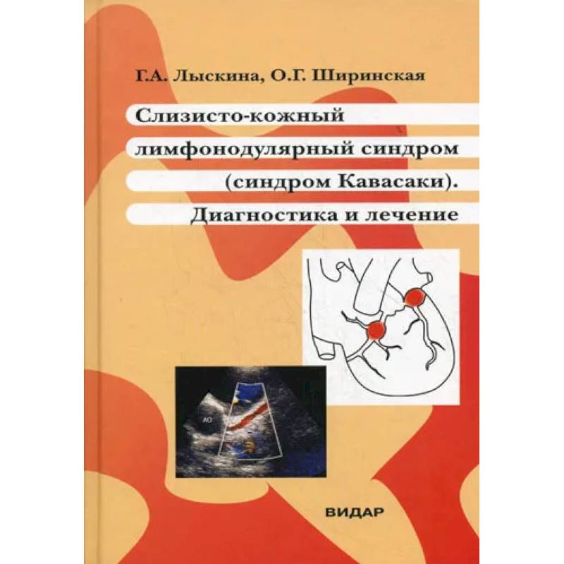 Фото Слизисто-кожный лимфонодулярный синдром (синдром Кавасаки). Диагностика и лечение