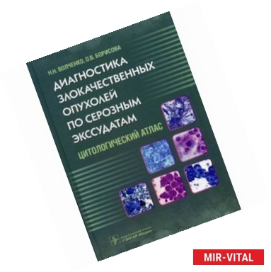 Фото Диагностика злокачественных опухолей по серозным экссудатам. Цитологический атлас