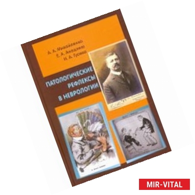 Фото Патологические рефлексы в неврологии