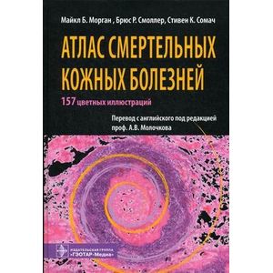Фото Атлас смертельных кожных болезней