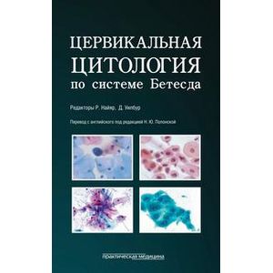 Фото Цервикальная цитология по системе Бетесда. Терминология, критерии и пояснения