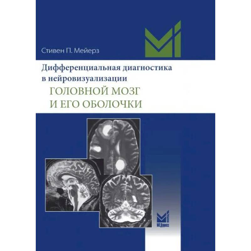 Фото Дифференциальная диагностика в нейровизуализации. Головной мозг и его оболочки
