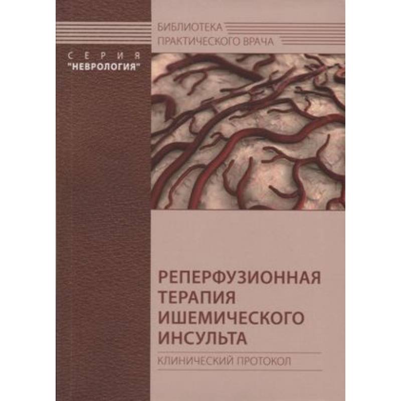 Фото Реперфузионная терапия ишемического инсульта. Клинический протокол