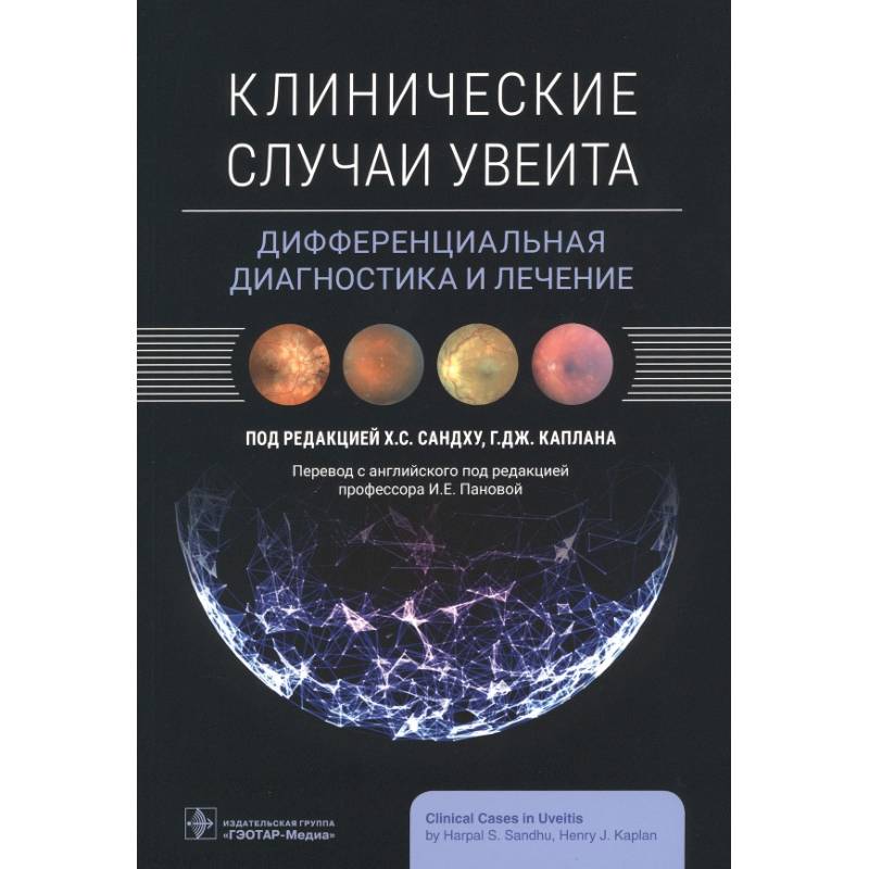 Фото Клинические случаи увеита. Дифференциальная диагностика и лечение