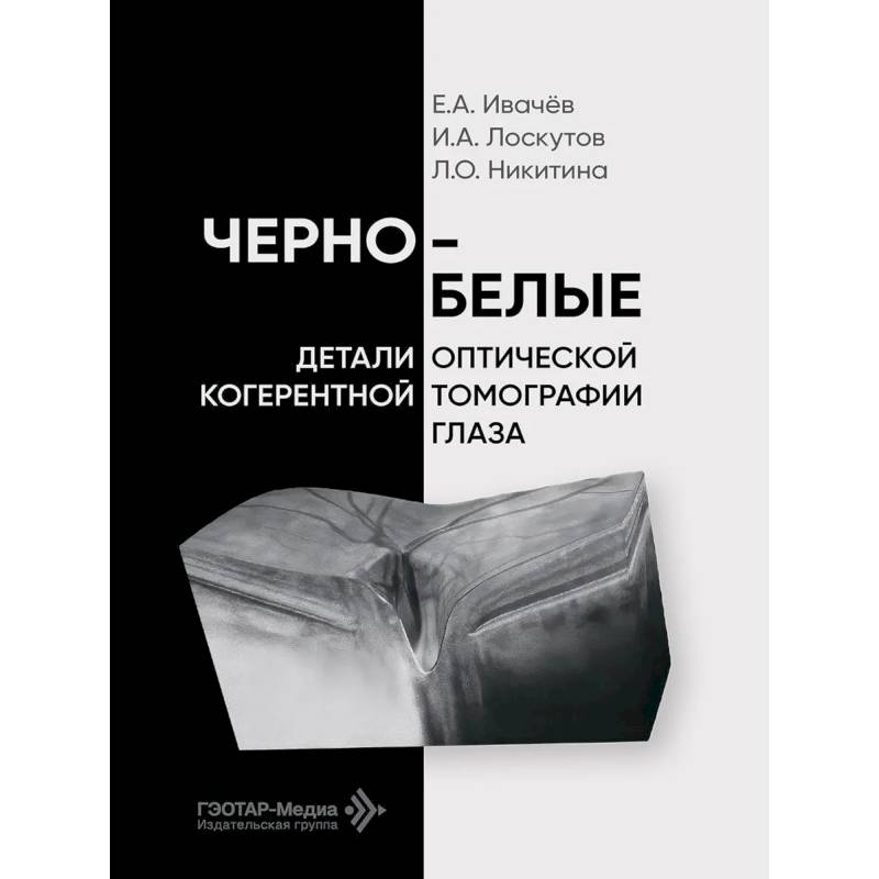 Фото Черно-белые детали оптической когерентной томографии глаза