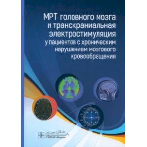 Фото МРТ головного мозга и транскраниальная электростимуляция у пациентов с хроническим нарушением