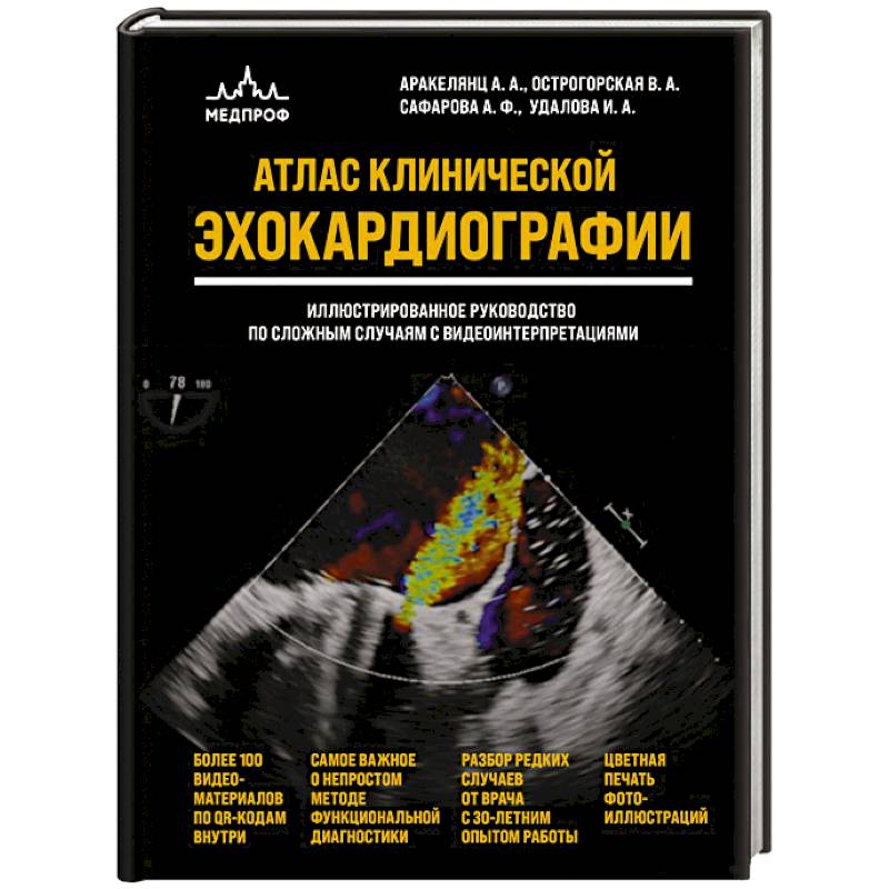 Фото Атлас ЭхоКГ. Иллюстрированное руководство по сложным случаям с видеоинтерпретациями