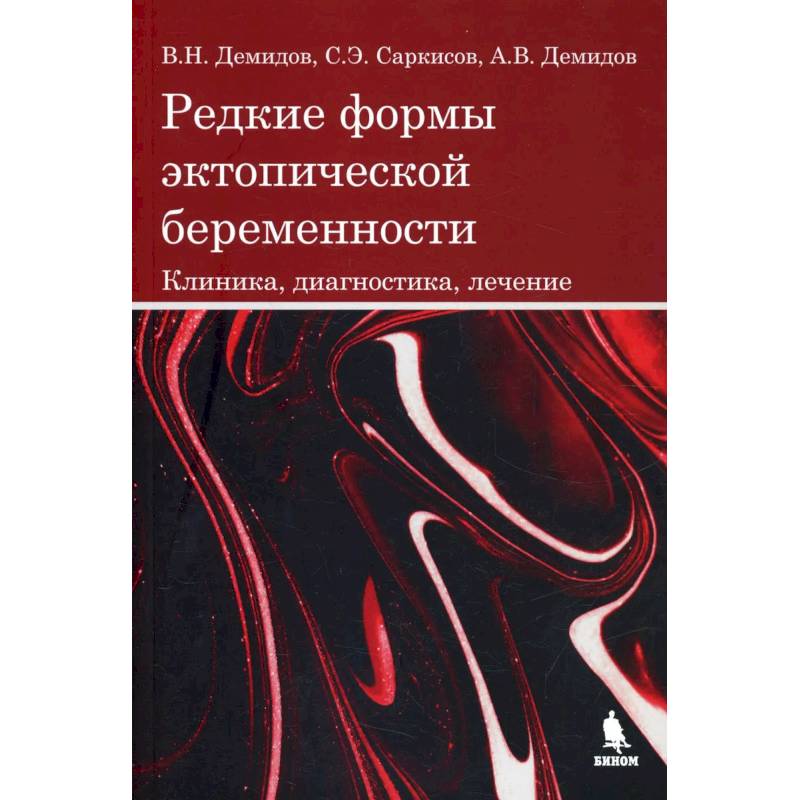 Фото Редкие формы эктопической беременности. Клиника, диагностика, лечение