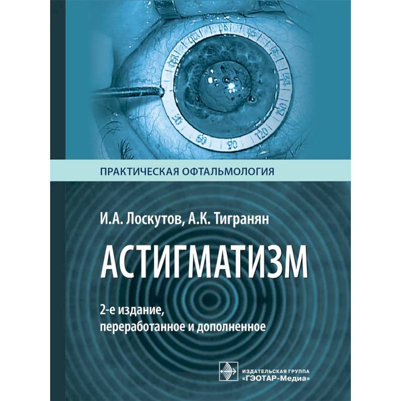 Фото Астигматизм. 2-е изд., перераб. и доп