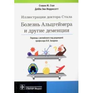 Фото Иллюстрации доктора Стала. Болезнь Альцгеймера и другие деменции