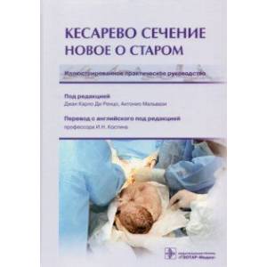 Фото Кесарево сечение. Новое о старом. Иллюстрированное практическое руководство