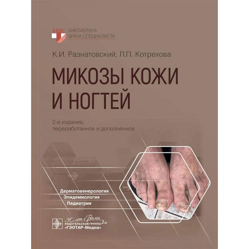 Фото Микозы кожи и ногтей