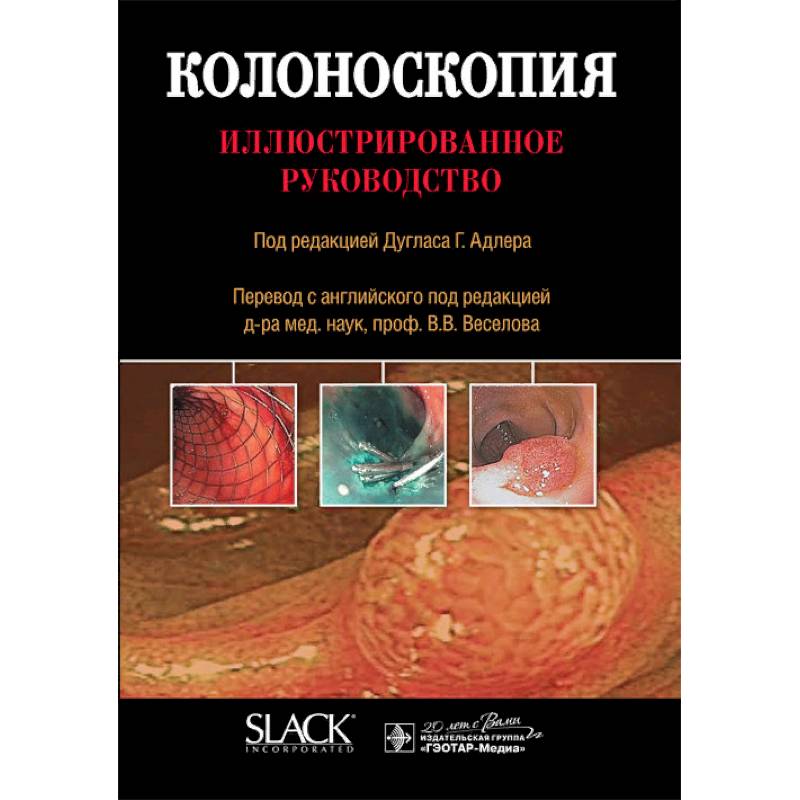 Фото Колоноскопия. Иллюстрированное руководство