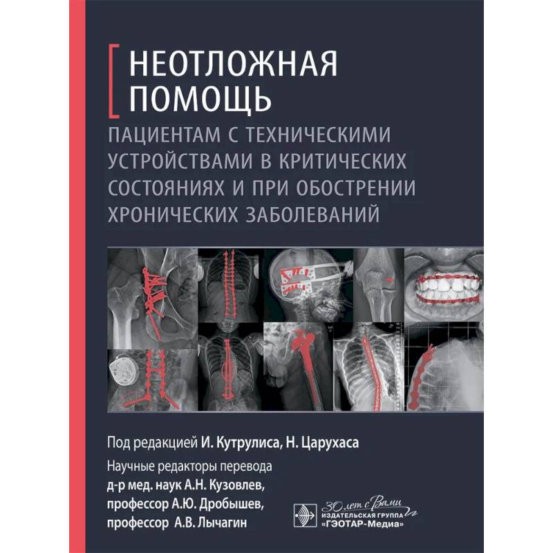 Фото Неотложная помощь пациентам с техническими устройствами в критических состояниях и при обострении хронических заболеваний
