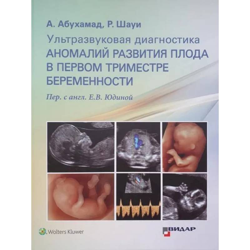 Фото Ультразвуковая диагностика аномалий развития плода в первом триместре беременности