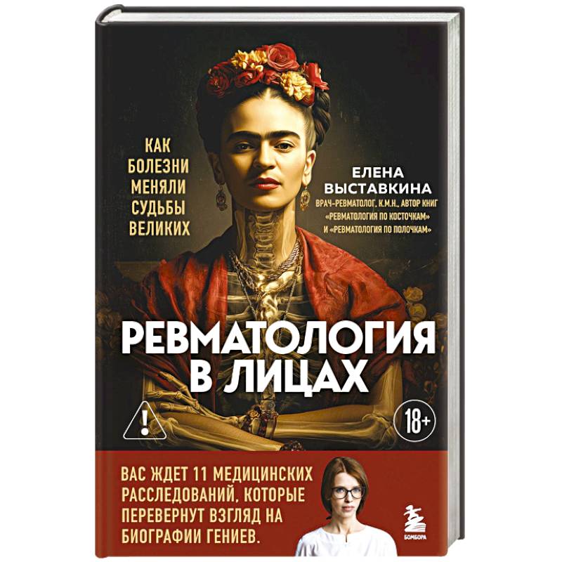 Фото Ревматология в лицах. Как болезни меняли судьбы великих