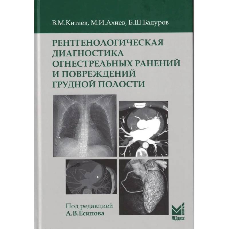 Фото Рентгенологическая диагностика огнестрельных ранений и повреждений грудной полости