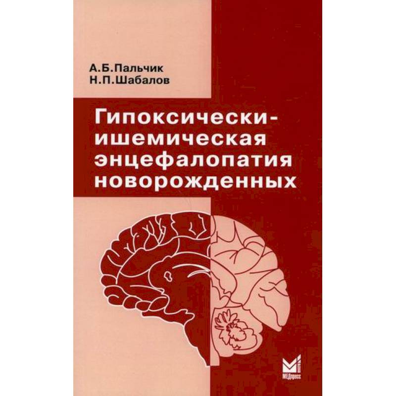 Фото Гипоксически-ишемическая энцефалопатия новорожденных