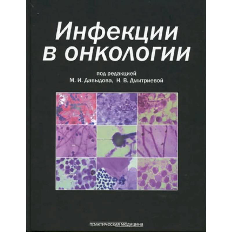 Фото Инфекции в онкологии