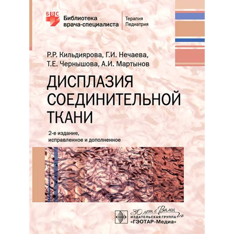 Фото Дисплазия соединительной ткани