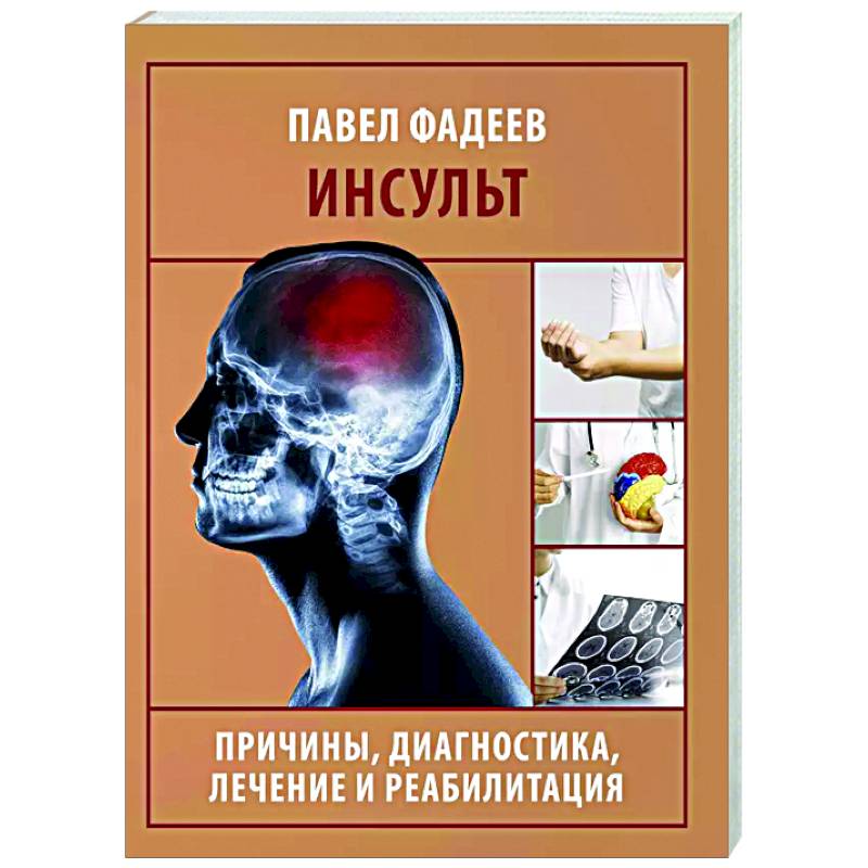 Фото Инсульт. Причины, диагностика, лечение и реабилитация