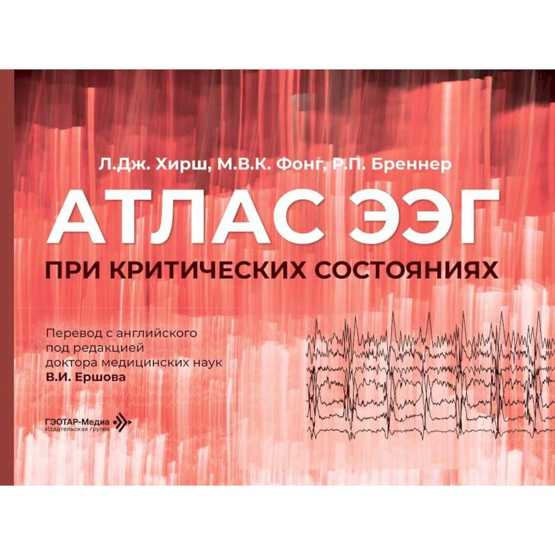Фото Атлас ЭЭГ при критических состояниях