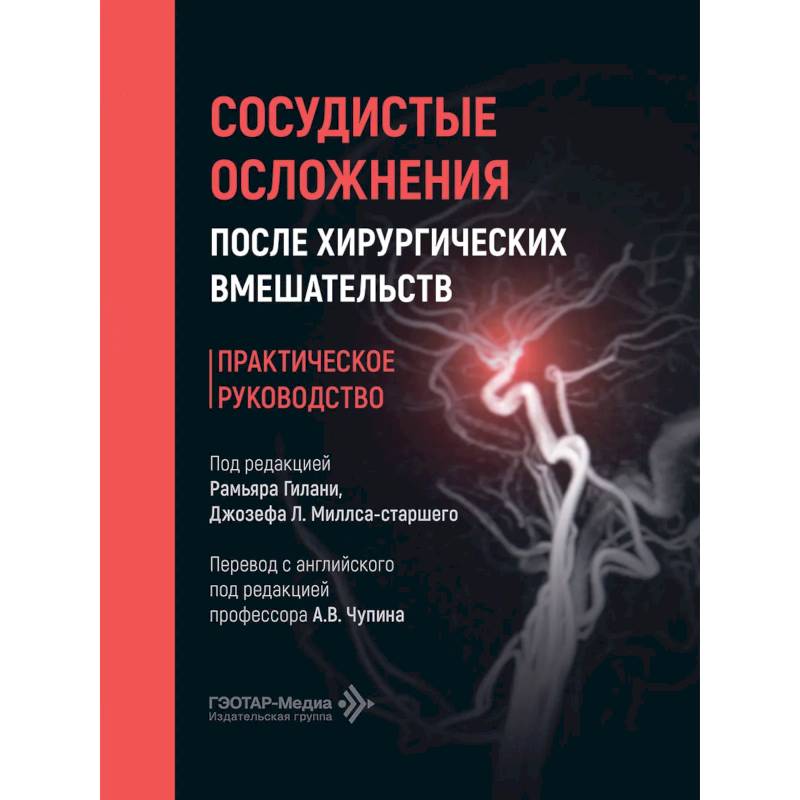 Фото Сосудистые осложнения после хирургических вмешательств. Практическое руководство