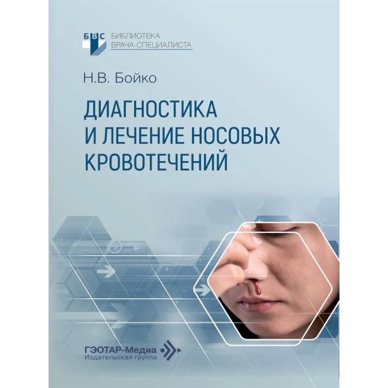 Фото Диагностика и лечение носовых кровотечений