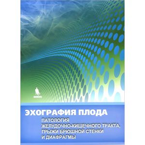 Фото Эхография плода. Патология желудочно-кишечного тракта, грыжи брюшной стенки и диафрагмы