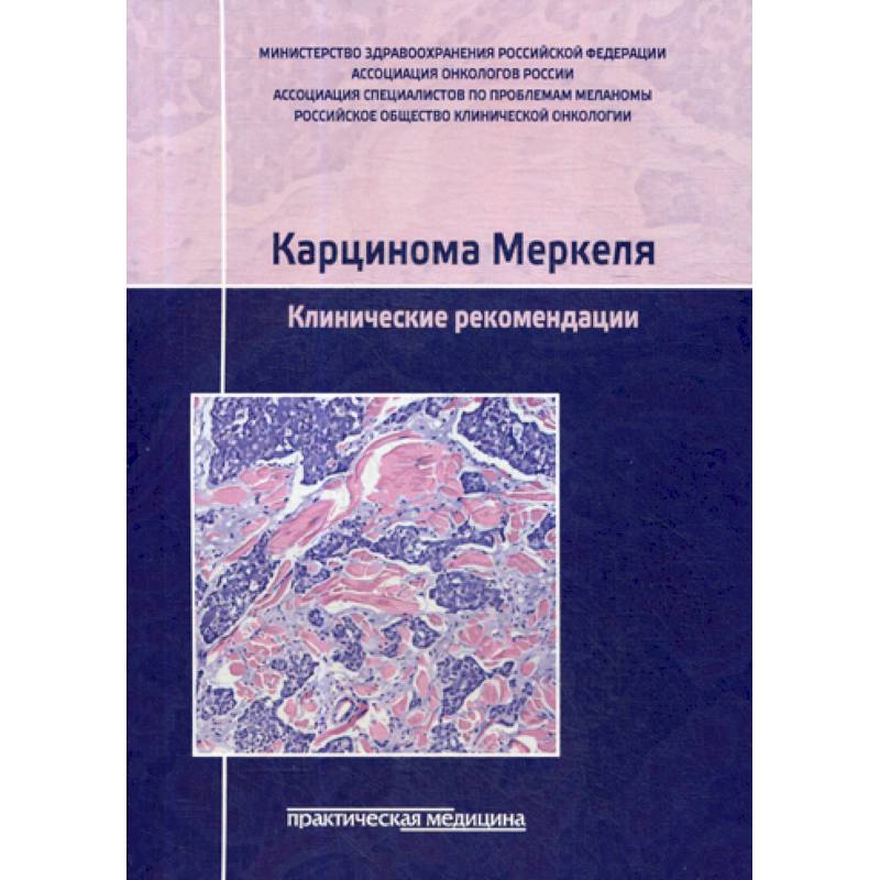 Фото Карцинома Меркеля. Клинические рекомендации