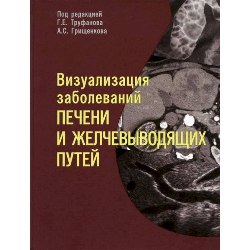 Фото Визуализация заболевантй печени и желчевыводящих путей. Учебное пособие