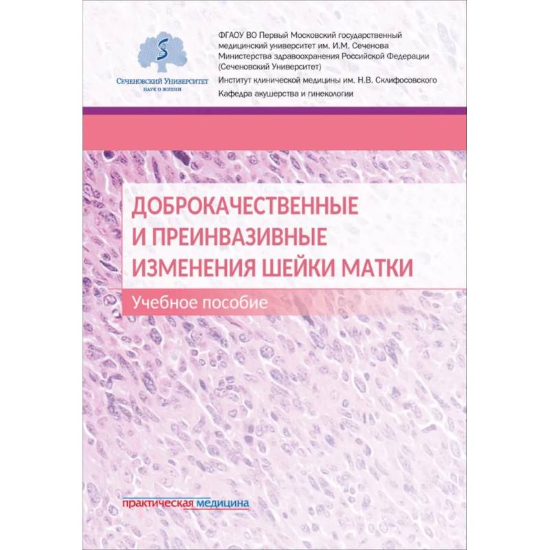 Фото Доброкачественные и преинвазивные изменения шейки матки. Учебное пособие