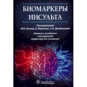 Фото Биомаркеры инсульта. Руководство