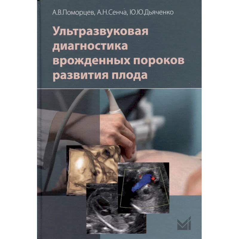 Фото Ультразвуковая диагностика врожденных пороков развития плода