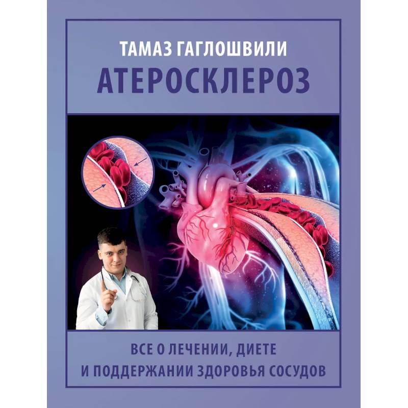 Фото Атеросклероз. Все о лечении, диете и поддержании здоровья сосудов