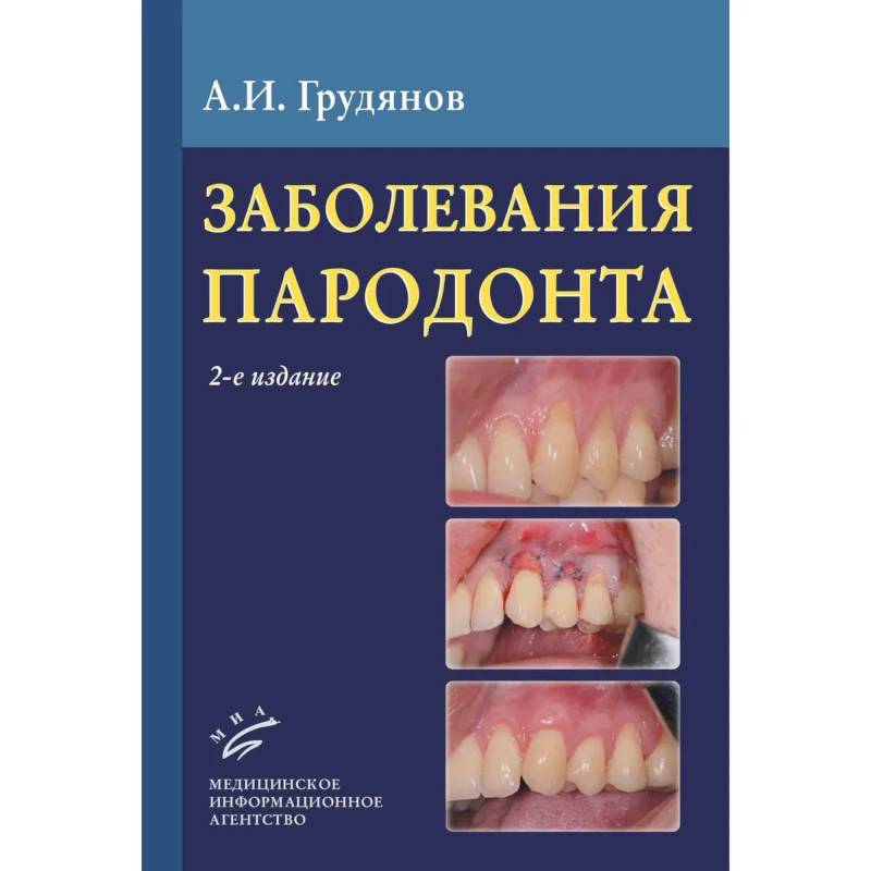 Фото Заболевания пародонта : Учебно-методическое руководство