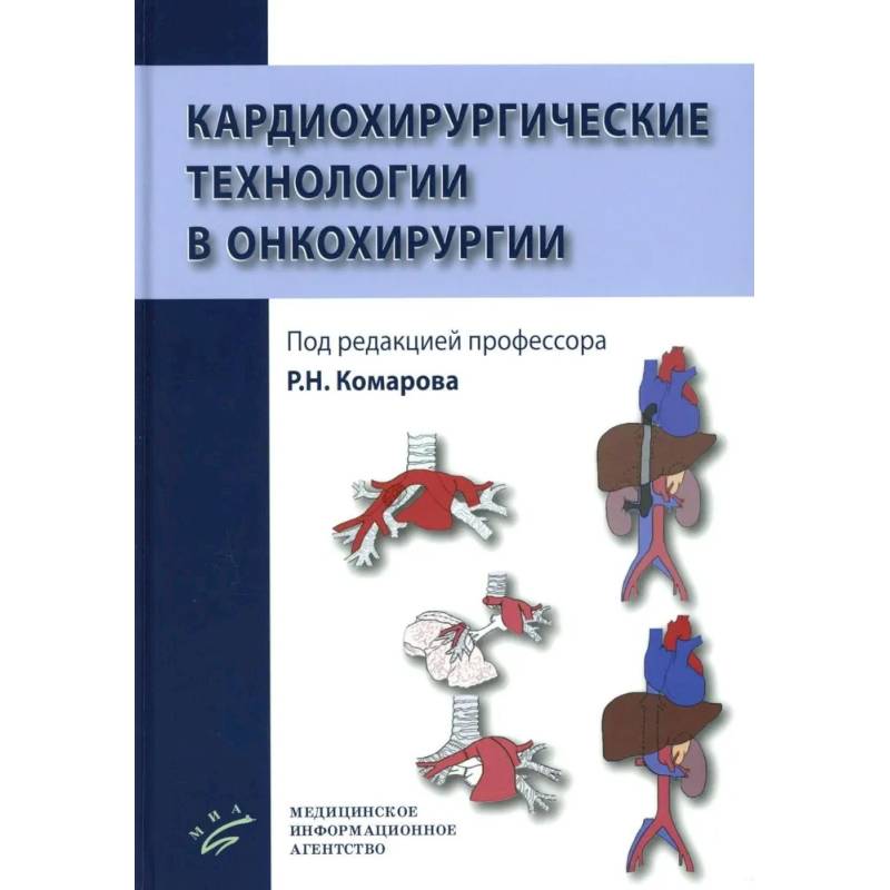 Фото Кардиохирургические технологии в онкохирургии