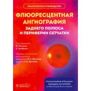 Фото Флюоресцентная ангиография заднего полюса и периферии сетчатки: практическое руководство