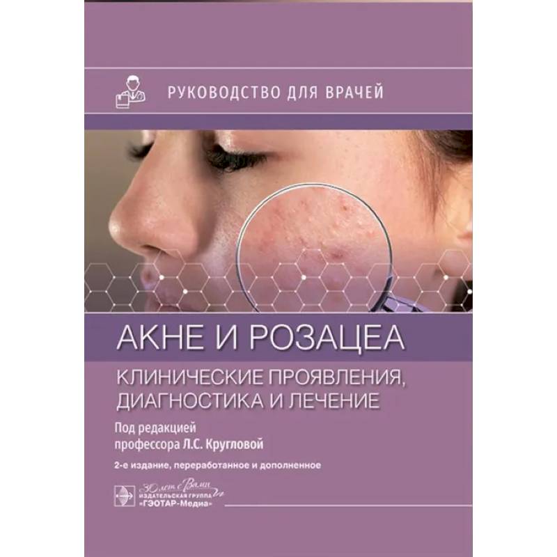 Фото Акне и розацеа. Клинические проявления, диагностика и лечение: руководство для врачей